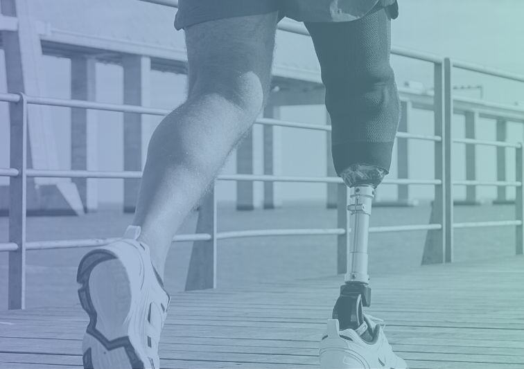 Persona con prótesis de rodilla que incorpora las últimas novedades y tecnologías
